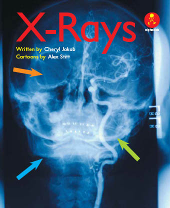 Level 18 : X-Rays